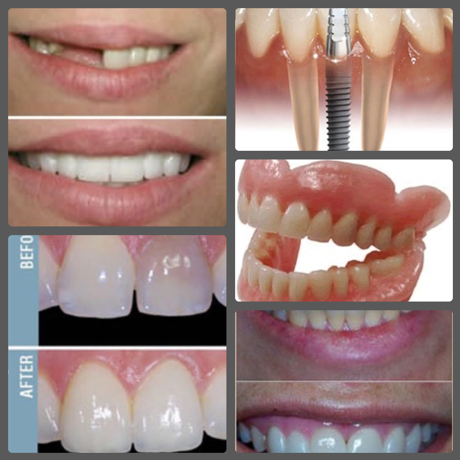 Best Dental Treatments at Most Popular and Experienced Dentist at Kondhwa, NIBM Road, Salunke